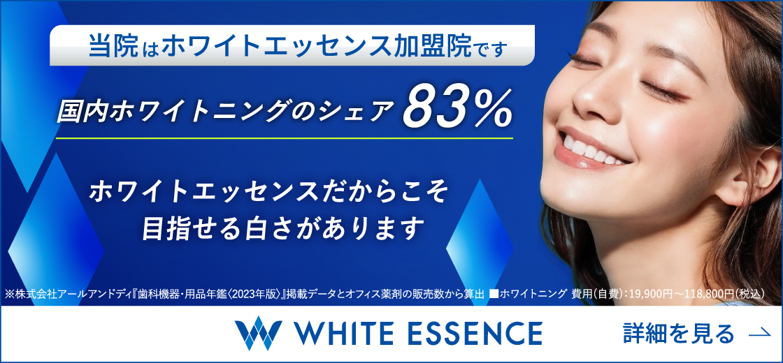 ホワイトエッセンス案内バナー