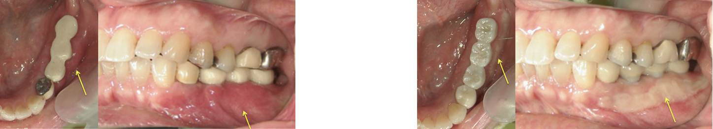 スクリーンショット 2023-10-18 10.55.40.png