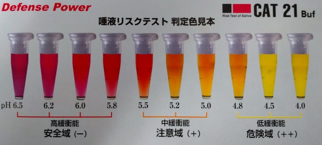 札幌のインプラント専門医の歯医者「谷口歯科診療所」 唾液リスクテスト